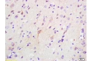 Formalin-fixed and paraffin embedded rat brain labeled with Anti Phospho-PKR (Thr446 + Thr451) Polyclonal Antibody (ABIN744818), Unconjugated at 1:200, followed by conjugation to the secondary antibody and DAB staining (EIF2AK2 anticorps  (pThr446, pThr451))