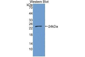 Western Blotting (WB) image for anti-Growth Arrest-Specific 6 (GAS6) (AA 136-311) antibody (ABIN1172547) (GAS6 anticorps  (AA 136-311))