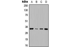 Western blot analysis of Cyclin D1 expression in HepG2 (A), NIH3T3 (B), rat muscle (C), rat kidney (D) whole cell lysates. (Cyclin D1 anticorps  (Center))