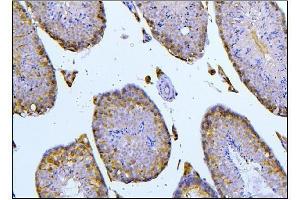 IHC analysis of BubR1/BUB1B using anti-BubR1/BUB1B antibody (ABIN7600962). (BUB1B anticorps  (AA 26-448))