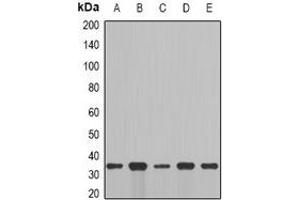 Western blot analysis of Cyclin C expression in MCF7 (A), NIH3T3 (B), mouse brain (C), mouse lung (D), rat liver (E) whole cell lysates. (Cyclin C anticorps)