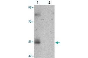 Western blot analysis of FOXD4L1 in A-20 cell lysate with FOXD4L1 polyclonal antibody  at 1 ug/mL in (lane 1) the absence and (lane 2) the presence of blocking peptide. (FOXD4L1 anticorps  (C-Term))