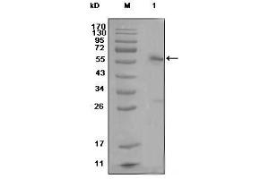 Western Blot showing ESR1 antibody used against MCF-7 cell lysate (1) (Estrogen Receptor alpha anticorps)