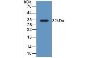 Detection of Recombinant TrxR1, Rat using Polyclonal Antibody to Thioredoxin Reductase 1 (TXNRD1) (TXNRD1 anticorps  (AA 208-433))