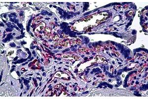 Human Placenta: Formalin-Fixed, Paraffin-Embedded (FFPE)