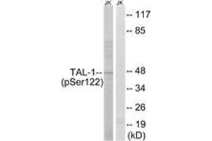 Western blot analysis of extracts from Jurkat cells treated with PMA 125ng/ml 30', using TAL-1 (Phospho-Ser122) Antibody. (TAL1 anticorps  (pSer122))