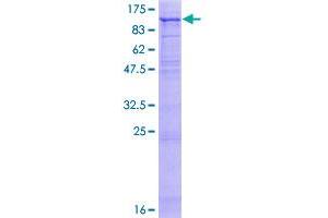 Image no. 1 for Fibroblast Activation Protein, alpha (FAP) (AA 1-760) protein (GST tag) (ABIN1353642)
