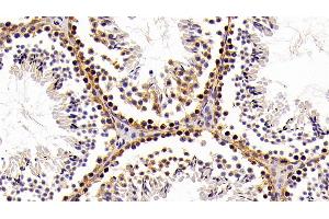 Detection of HMGB1 in Mouse Testis Tissue using Polyclonal Antibody to High Mobility Group Protein 1 (HMGB1) (HMGB1 anticorps  (AA 1-215))