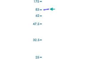 Image no. 1 for KIN, Antigenic Determinant of RecA Protein Homolog (KIN) (AA 1-393) protein (GST tag) (ABIN1308690)