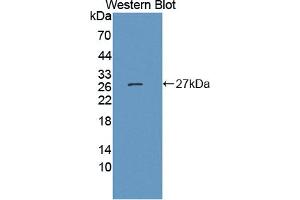 Western blot analysis of the recombinant protein. (JAM3 anticorps  (AA 30-241))