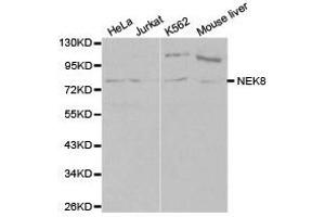 Western Blotting (WB) image for anti-NIMA-Related Kinase 8 (NEK8) antibody (ABIN1873874) (NEK8 anticorps)