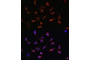 Immunofluorescence analysis of L929 cells using PDCD5 Rabbit pAb (ABIN6132965, ABIN6145338, ABIN6145339 and ABIN6223132) at dilution of 1:100. (PDCD5 anticorps  (AA 1-125))