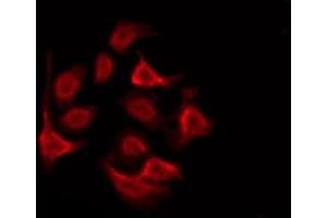 ABIN6276025 staining Hela by IF/ICC. (GPRC5D anticorps  (Internal Region))