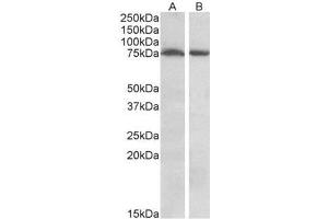 AP23695PU-N STK39 / SPAK Antibody of Mouse (A) and Rat (B) Brain (35µg protein in RIPA buffer). (STK39 anticorps  (Internal Region))
