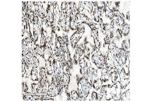 IHC analysis of DDX5 using anti-DDX5 antibody (ABIN7602561). (DDX5 anticorps  (AA 85-328))