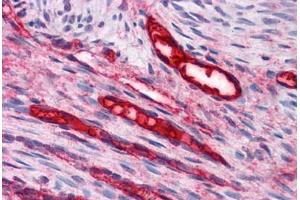 Human Uterus, Vessels: Formalin-Fixed, Paraffin-Embedded (FFPE)