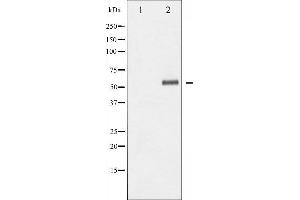 Western blot analysis of Elk1 phosphorylation expression in UV treated Jurkat whole cell lysates,The lane on the left is treated with the antigen-specific peptide.