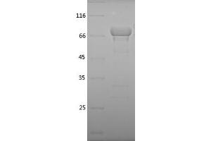 Western Blotting (WB) image for Heat Shock 70kDa Protein 5 (Glucose-Regulated Protein, 78kDa) (HSPA5) (AA 19-654) protein (His tag) (ABIN7123271) (GRP78 Protein (AA 19-654) (His tag))