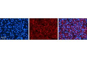 Rabbit Anti-PDLIM5 Antibody   Formalin Fixed Paraffin Embedded Tissue: Human Liver Tissue Observed Staining: Cytoplasm in hepatocytes Primary Antibody Concentration: 1:100 Other Working Concentrations: N/A Secondary Antibody: Donkey anti-Rabbit-Cy3 Secondary Antibody Concentration: 1:200 Magnification: 20X Exposure Time: 0.