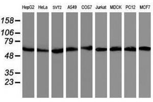 Image no. 6 for anti-V-Akt Murine Thymoma Viral Oncogene Homolog 1 (AKT1) antibody (ABIN1496554) (AKT1 anticorps)