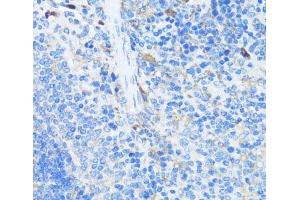 Immunohistochemistry of paraffin-embedded Mouse spleen using EIF3J Polyclonal Antibody at dilution of 1:100 (40x lens). (EIF3S1 anticorps)