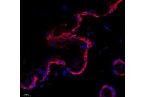 Immunofluorescence of paraffin embedded rat skin using collagen alpha-1 (V) (ABIN7073547) at dilution of 1: 1500 (400x lens) (Collagen Type V anticorps)