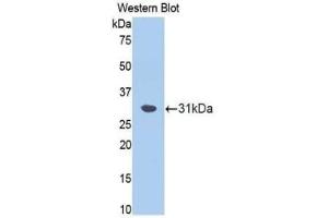 Western blot analysis of the recombinant protein. (Fascin anticorps  (AA 8-260))