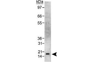 Western blot analysis of CBX5 in HeLa whole cell lysate using CBX5 polyclonal antibody .