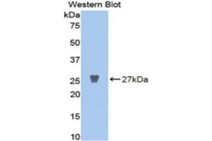 Western Blotting (WB) image for anti-Matrix Metalloproteinase 2 (MMP2) (AA 445-660) antibody (ABIN1078307) (MMP2 anticorps  (AA 445-660))