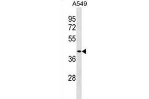 Western Blotting (WB) image for anti-Dipeptidase 1 (Renal) (DPEP1) antibody (ABIN3001069)
