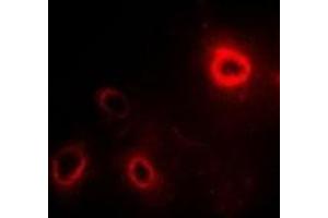 Immunofluorescent analysis of RPLP1 staining in SW480 cells. (RPLP1 anticorps)