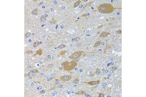 Immunohistochemistry of paraffin-embedded rat brain using EIF2S3 antibody (ABIN6130363, ABIN6140051, ABIN6140052 and ABIN6222259) at dilution of 1:100 (40x lens). (EIF2S3 anticorps  (AA 173-472))