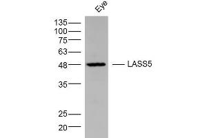 Mouse Eye lysates probed with LASS5 Polyclonal Antibody, Unconjugated  at 1:300 dilution and 4˚C overnight incubation. (LASS5 anticorps  (AA 101-200))