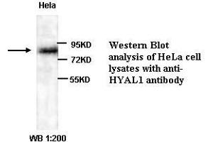 Image no. 1 for anti-Hyaluronidase-1 (HYAL1) (Internal Region) antibody (ABIN791003) (HYAL1 anticorps  (Internal Region))