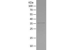 Western Blotting (WB) image for Nuclear Receptor Subfamily 2, Group E, Member 3 (NR2E3) (AA 113-245) protein (His-IF2DI Tag) (ABIN7124213)