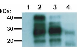 Western blotting analysis of Creutzfeld-Jakob disease (CJD) negative (lane 1, 2) and CJD positive (lane 3, 4) human brain material using anti-PrP antibody (clone EM-20). (PRNP anticorps)