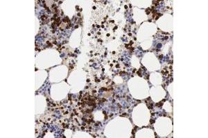 Immunohistochemistry (Formalin/PFA-fixed paraffin-embedded sections) of human bone marrow with FCN1 polyclonal antibody  shows strong cytoplasmic positivity in bone marrow poietic cells.