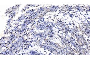 Detection of IL17F in Human Small intestine Tissue using Monoclonal Antibody to Interleukin 17F (IL17F)