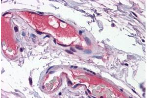 Human Vessels: Formalin-Fixed, Paraffin-Embedded (FFPE)