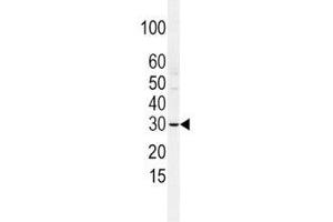 Western blot analysis of SLUG antibody and HCSMC lysate.