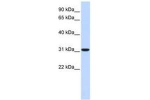 Image no. 1 for anti-Carbonic Anhydrase VIII (CA8) (C-Term) antibody (ABIN6740749) (CA8 anticorps  (C-Term))