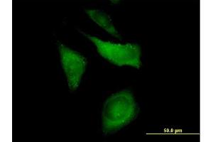 Immunofluorescence of purified MaxPab antibody to CAP1 on HeLa cell. (CAP1 anticorps  (AA 1-475))