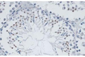 Immunohistochemistry of paraffin-embedded Mouse testis using MSH6 Polyclonal Antibody at dilution of 1:100 (40x lens). (MSH6 anticorps)
