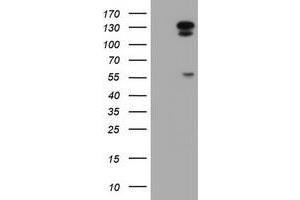 Western Blotting (WB) image for anti-ATP/GTP Binding Protein 1 (AGTPBP1) (AA 368-753) antibody (ABIN1491462) (AGTPBP1 anticorps  (AA 368-753))