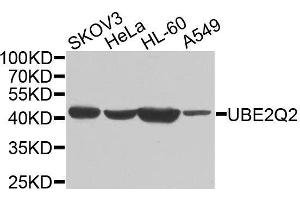 anti-Ubiquitin-Conjugating Enzyme E2Q Family Member 2 (UBE2Q2) (AA 1-150) antibody