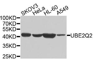 Western blot analysis of extracts of various cell lines, using UBE2Q2 antibody. (UBE2Q2 anticorps  (AA 1-150))