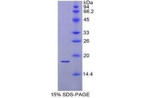 SDS-PAGE (SDS) image for Retinol Binding Protein 2, Cellular (RBP2) (AA 1-134) protein (His tag) (ABIN2122011)