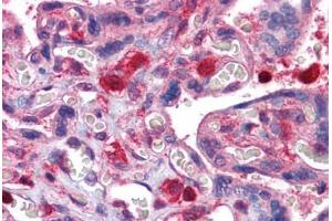 Human Placenta: Formalin-Fixed, Paraffin-Embedded (FFPE)