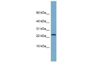LRRC20 antibody used at 1 ug/ml to detect target protein.