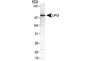 Western blot analysis of LPO in MDA-MB-231 cell lysate using LPO polyclonal antibody . (LPO anticorps  (AA 300-400))